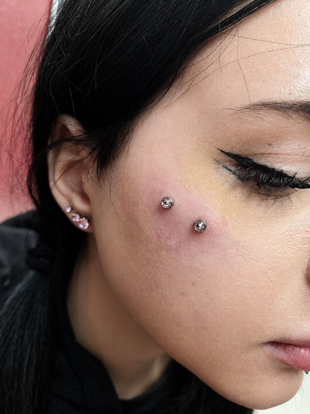 Double cheek dermal piercing with crystal tops, close-up