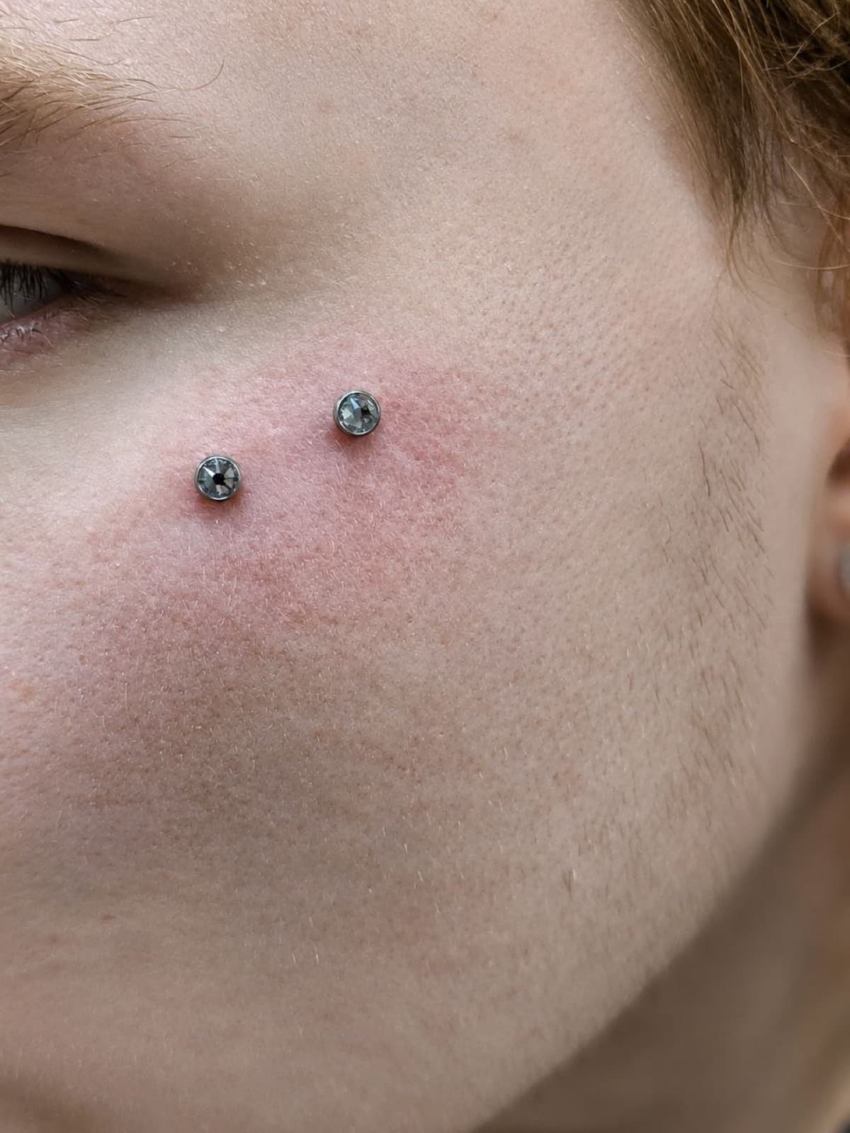 Double cheek dermal piercing with crystal tops