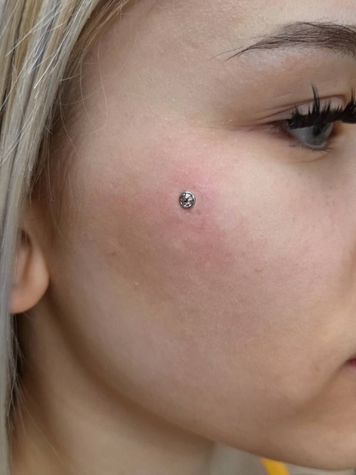 Single microdermal piercing on the cheek
