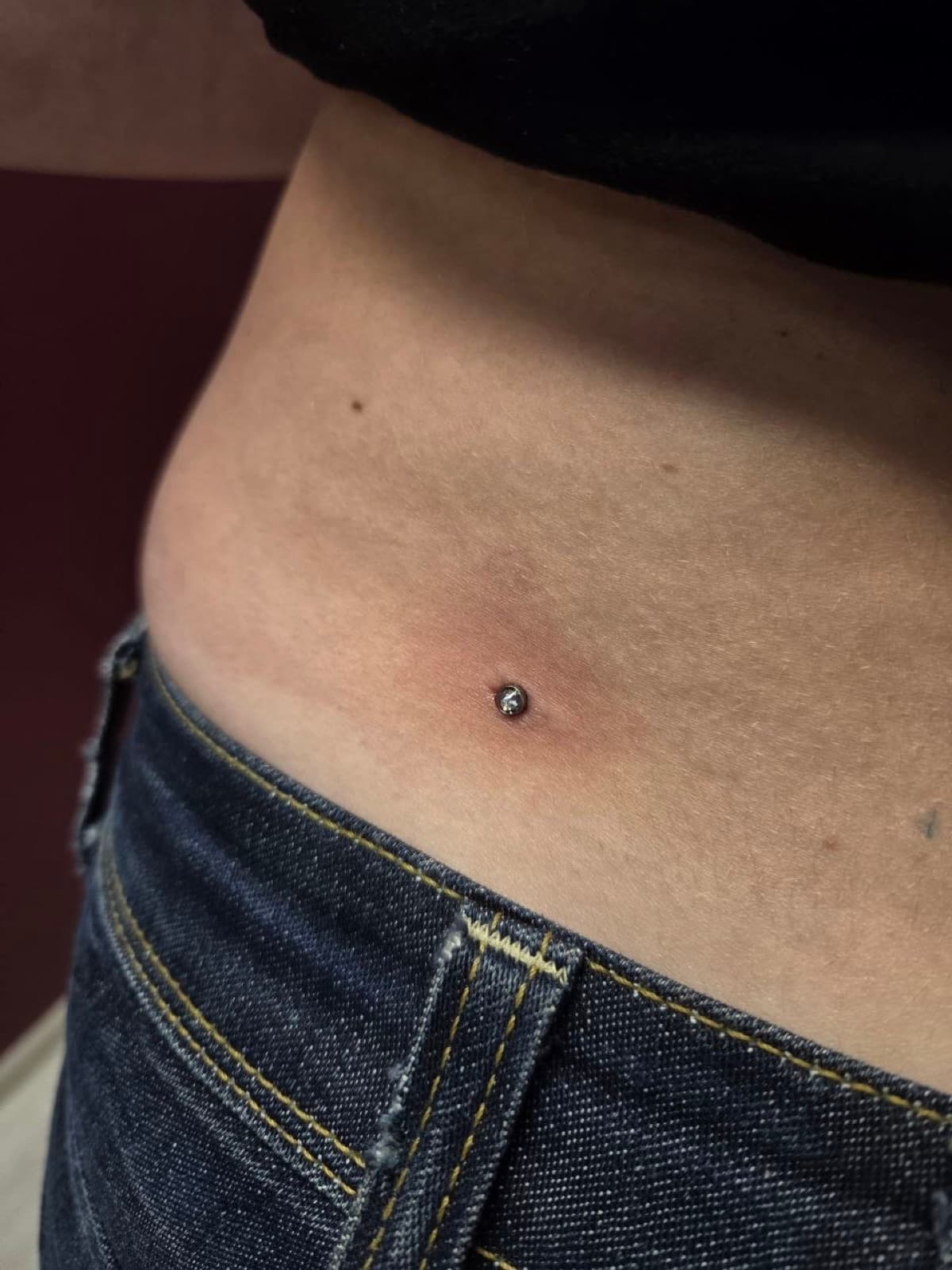 Single surface dermal piercing on the side with a clear crystal top